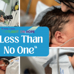 photo collage of a newborn with Prader-Willi Syndrome in the NICU