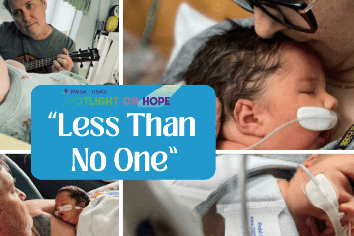 photo collage of a newborn with Prader-Willi Syndrome in the NICU